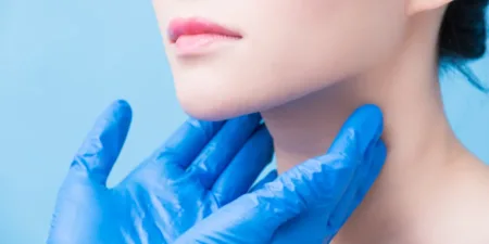 Causes, symptoms and treatment of hypothyroidism - AdobeStock
