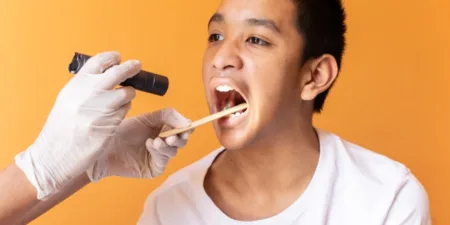 What Is Tonsillitis And How To Treat It? - tonsillitis