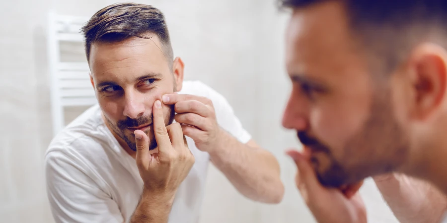 How to Reduce Pimples and Acne - prevent pimples How to Reduce Pimples and Acne - prevent pimples
