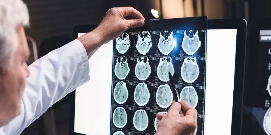 Types of Headaches and How To Get a Diagnosis - trauma headache Types of Headaches and How To Get a Diagnosis - trauma headache