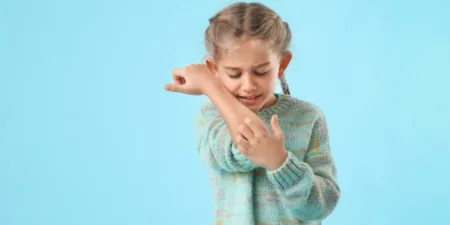 What You Need to Know About Flea Bites - flea bites