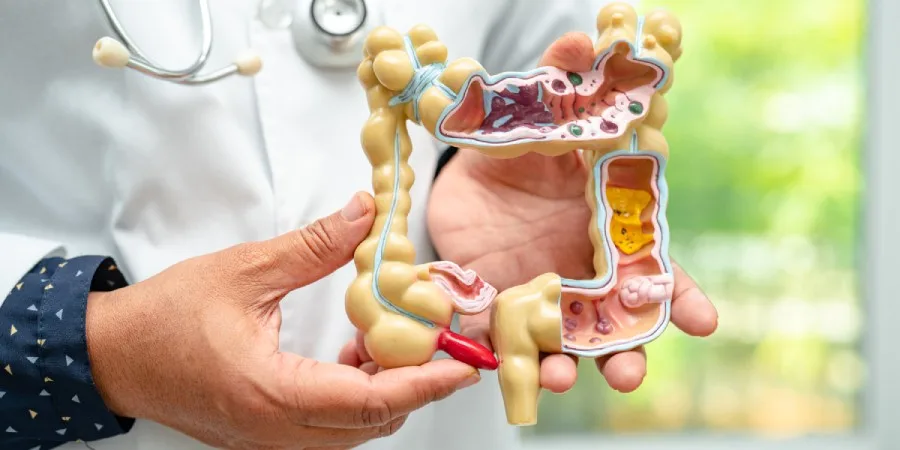 8 Science-Backed Health Benefits of Apple Cider Vinegar - acv gut health