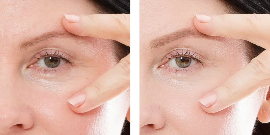 The Most Important Benefits of Taking Collagen Supplements - collagen skin The Most Important Benefits of Taking Collagen Supplements - collagen skin